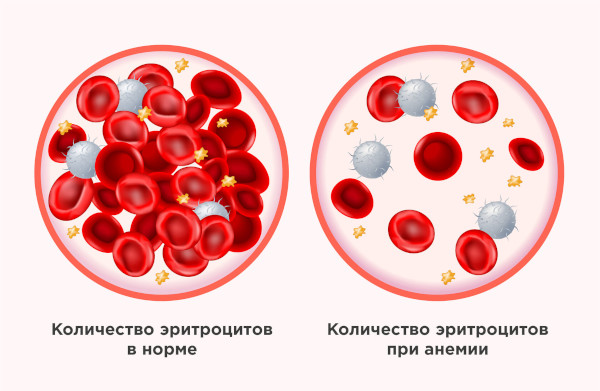 Средний объем тромбоцитов (MPV) понижен у женщин. Причины