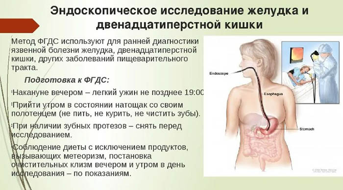 Эндоскопия желудка. Что это такое, исследование, подготовка