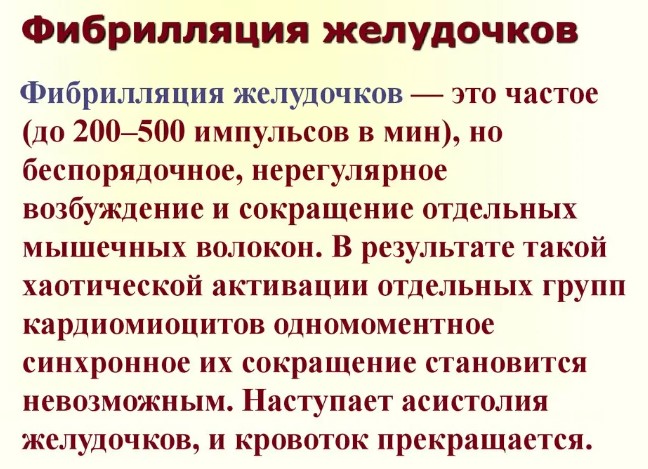 Фибрилляция желудочков. Это что такое