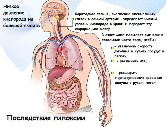 Гипоксия. Что это такое у взрослых, симптомы и лечение