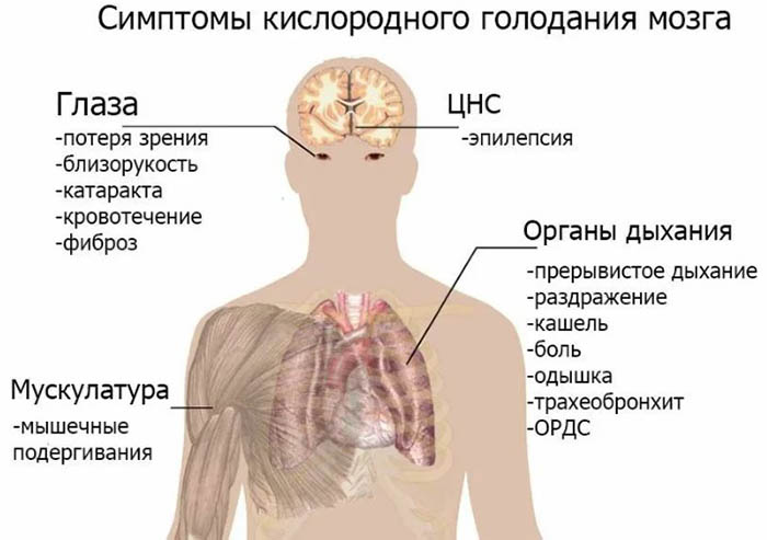 Гипоксия. Что это такое у взрослых, симптомы и лечение