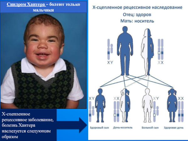 Хромосомные мутации (аберрации, перестройки). Что это такое, примеры