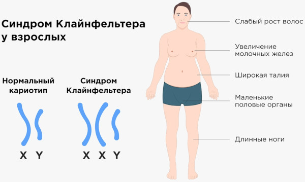 Хромосомные мутации (аберрации, перестройки). Что это такое, примеры