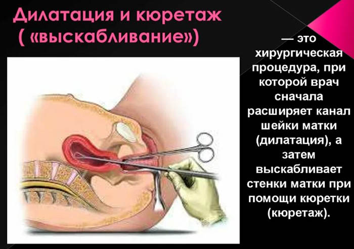 Имплантационное окно при ЭКО. Как определить в криопротоколе