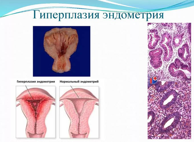 Имплантационное окно при ЭКО. Как определить в криопротоколе