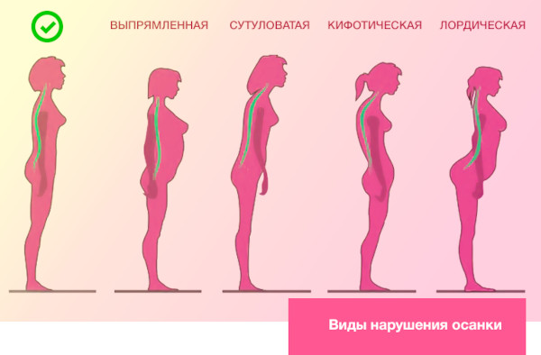 Как проверить свою осанку (правильность) в домашних условиях у стены