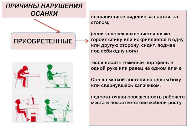 Как проверить свою осанку (правильность) в домашних условиях у стены