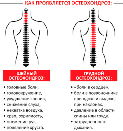 Можно ли вылечить остеохондроз полностью навсегда шейного, поясничного, грудного отдела