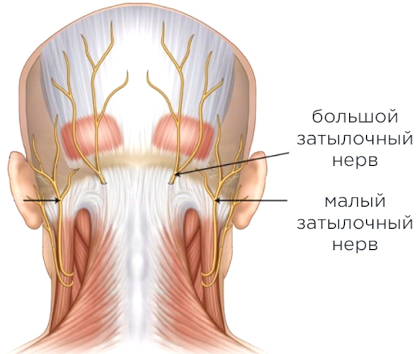 Невралгия (воспаление, неврит) затылочного нерва. Симптомы и лечение