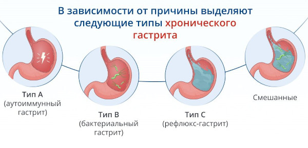 Опасность гастрита желудка у детей с повышенной кислотностью