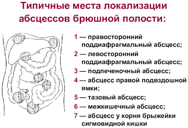 Опасность гастрита желудка у детей с повышенной кислотностью