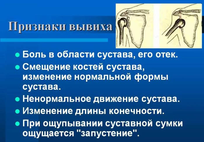 Первая помощь при вывихе конечности и растяжении связок доврачебная