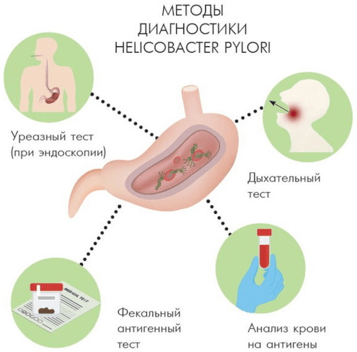 Повышенная кислотность желудка (желудочного сока). Симптомы, лечение