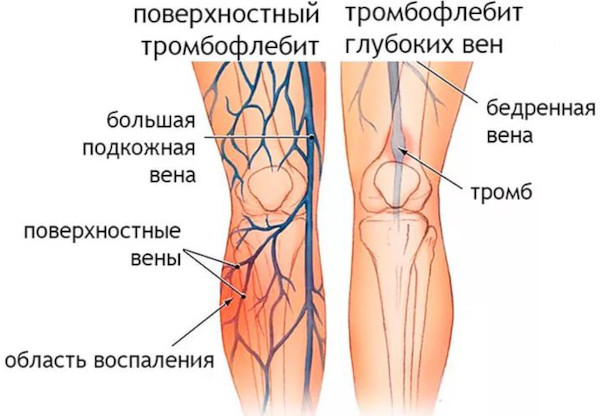 Сок подорожника большого. Инструкция по применению, цена