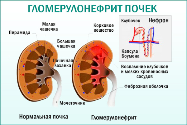 Цитостатики (цитостатические препараты). Что это такое, список