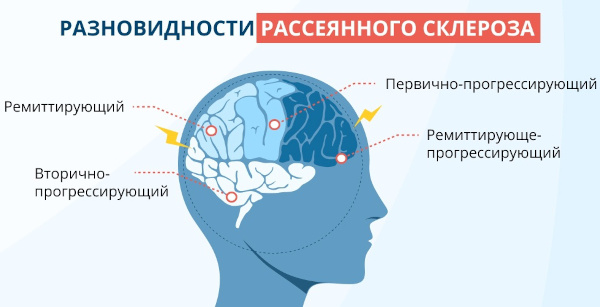 Цитостатики (цитостатические препараты). Что это такое, список