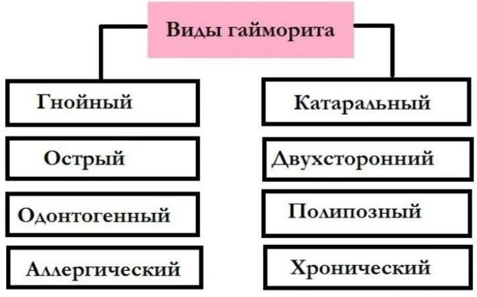 Верхнечелюстной синусит: острый, хронический. Что это такое, лечение