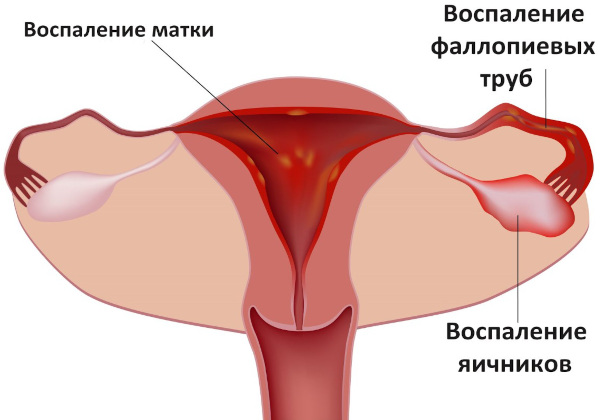 Выделения после гистероскопии матки с выскабливанием. Как долго могут длиться