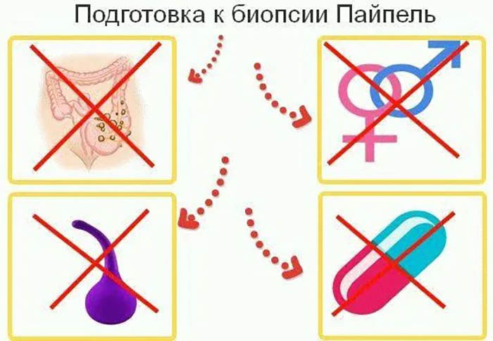 Аспирационная биопсия эндометрия (АБЭ). Что это такое