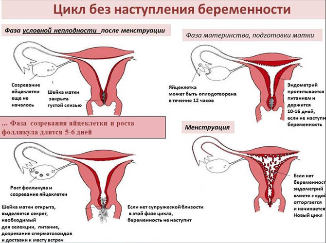 Болезненные месячные. Причины, что делать, как облегчить