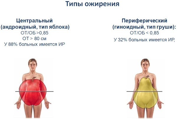 Экзогенно-конституциональное ожирение 1-2-3 степени у женщин