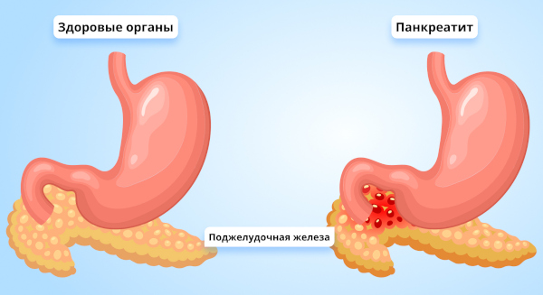 Фурадонин. Инструкция по применению, цена, отзывы