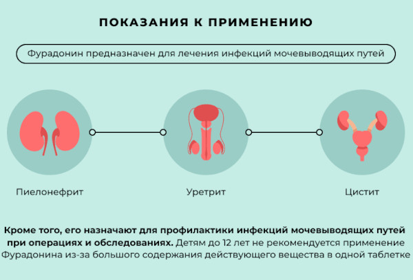 Фурадонин. Инструкция по применению, цена, отзывы