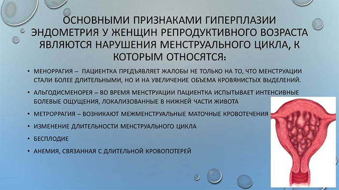 Гиперплазия яичников у женщин. Что это, что значит, лечение