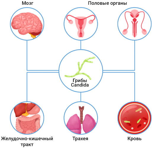 Грибковая инфекция в горле. Симптомы, лечение