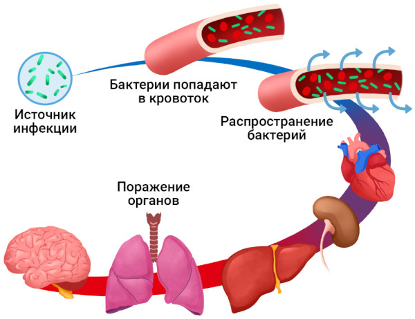 Хронический абсцесс легкого. Клинические рекомендации, лечение