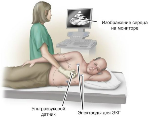 Ишемическая болезнь головного мозга. Что это у пожилых