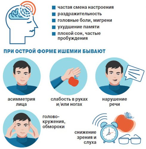 Ишемическая болезнь головного мозга. Что это у пожилых