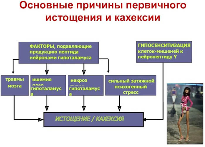 Кахексия. Что это такое, код по МКБ 10 у взрослых, причины