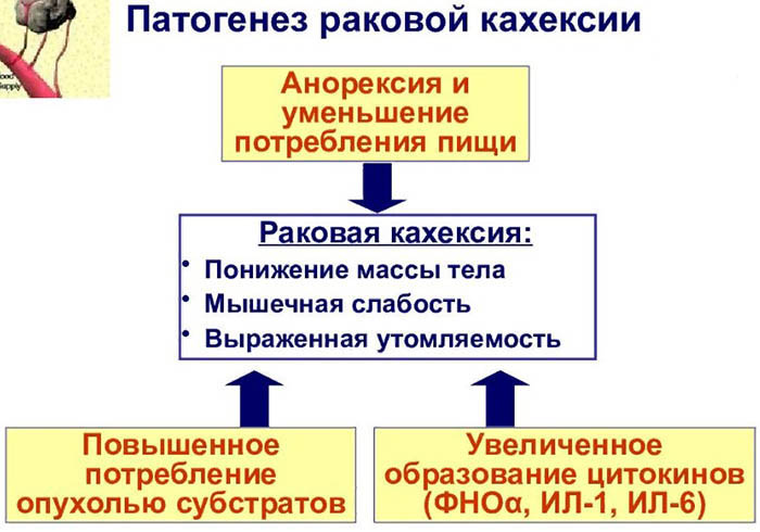 Кахексия. Что это такое, код по МКБ 10 у взрослых, причины