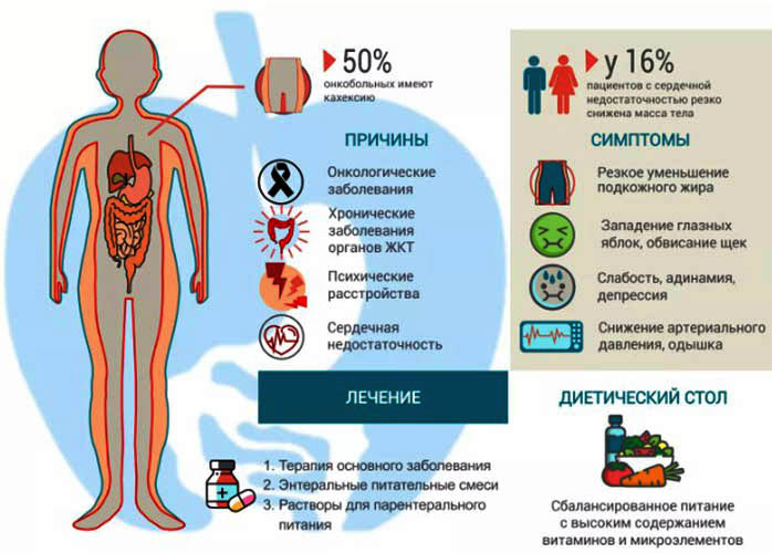 Кахексия. Что это такое, код по МКБ 10 у взрослых, причины