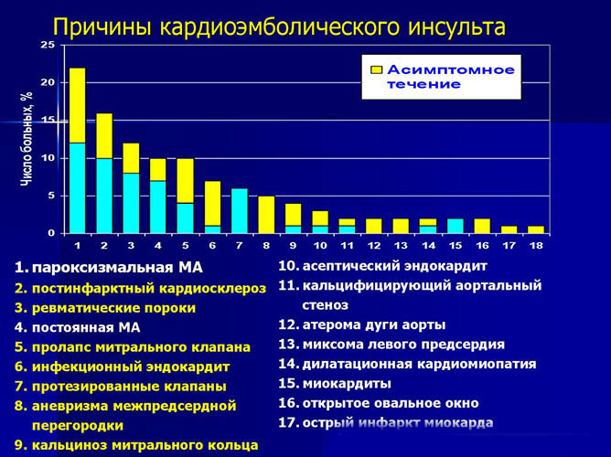 Кардиоэмболический инсульт. Что это, причины, лечение