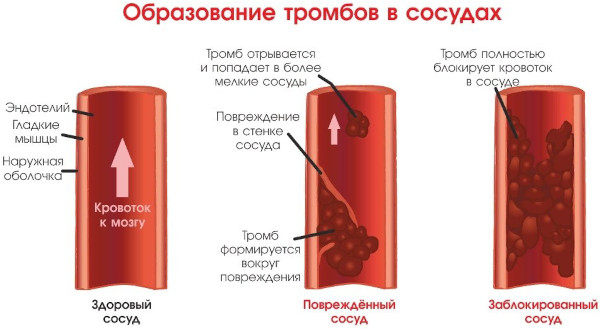 Медиана. Побочные эффекты при длительном применении