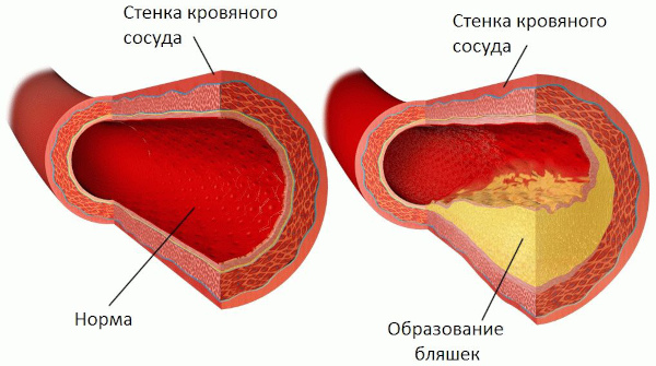 Медиана. Побочные эффекты при длительном применении