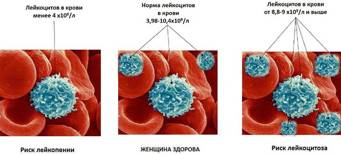 Низкие лейкоциты в крови у взрослого. Причины, как поднять