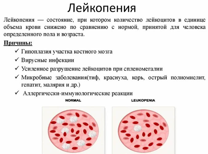 Низкие лейкоциты в крови у взрослого. Причины, как поднять