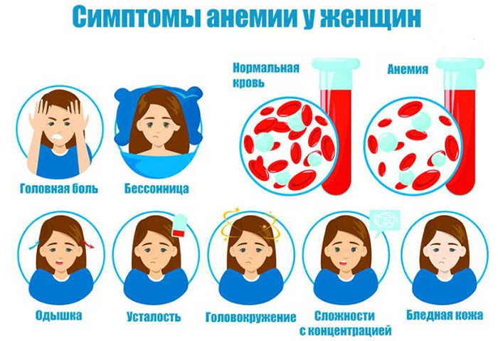 Опасность анемии для женщин после 40-45-50 лет