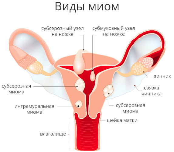 Первые месячные у девочек. Во сколько лет начинается менструация