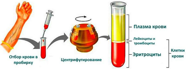 Полицитемия вторичная (ложная). Прогноз, что это за болезнь