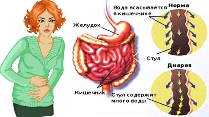 Понос после антибиотиков у взрослого. Что делать, лечение