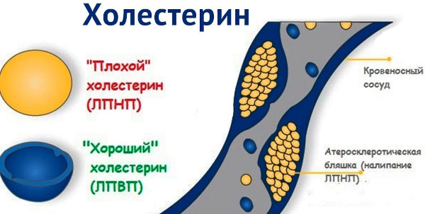 Цереброваскулярная болезнь (ЦВБ). Что это такое, симптомы, лечение