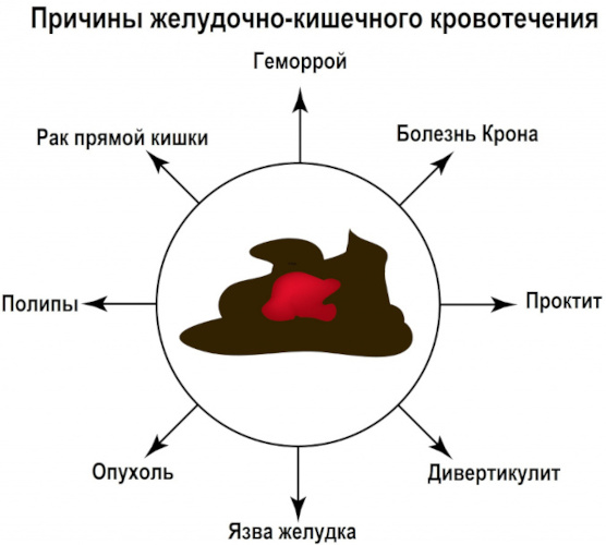 Унопрост. Инструкция по применению, цена, побочные действия