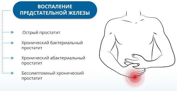 Унопрост. Инструкция по применению, цена, побочные действия