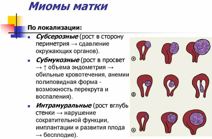 Увеличена матка. Причины, почему, кроме беременности