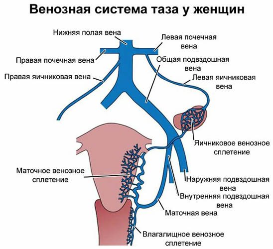 Варикозное расширение вен матки. Лечение