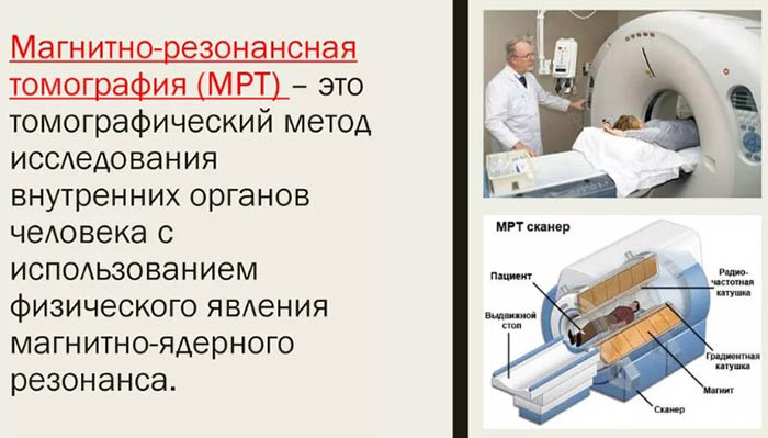 Варикозное расширение вен матки. Лечение